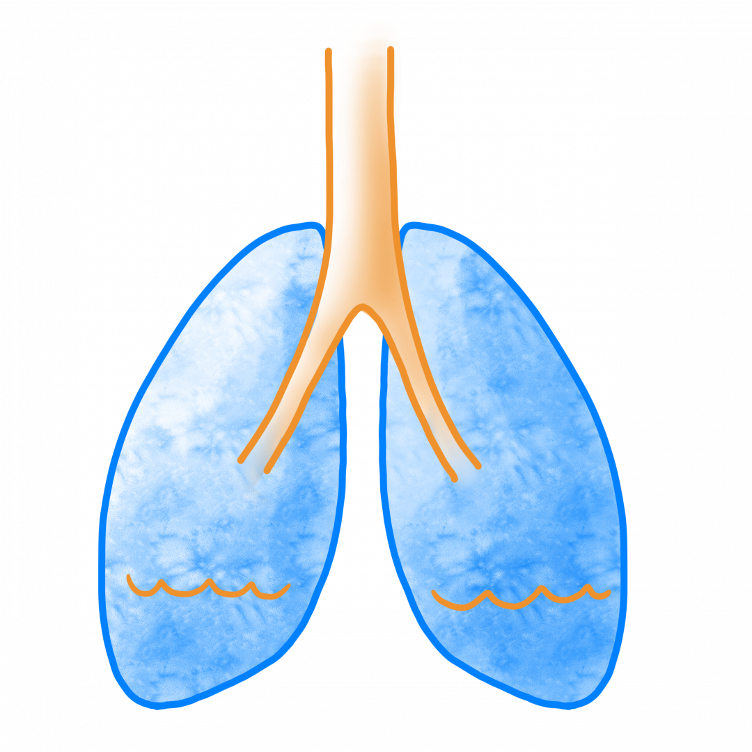 Fluid-filled lung